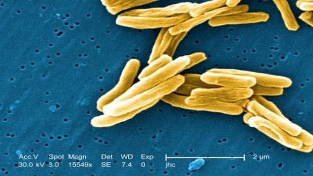 Scientists Explain Why Russian Tuberculosis is the Most Infectious