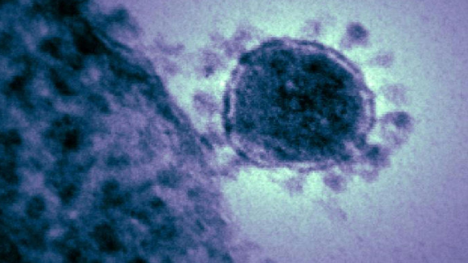 Researcher Examines the Predictors of 3- and 30-Day Mortality in MERS-CoV Patients