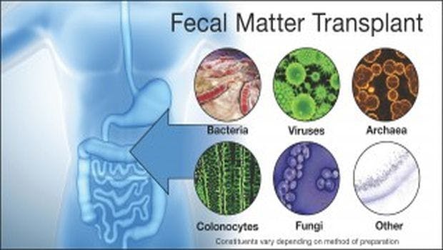 Scientific Literature on Fecal Transplantation Continues to Increase