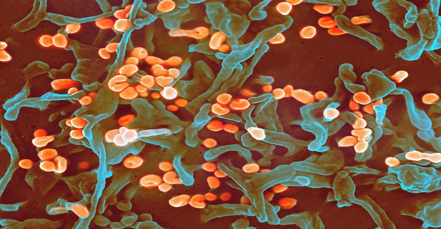 Genomic Analysis Offers Insight Into 2018 Nigeria Lassa Fever Outbreak