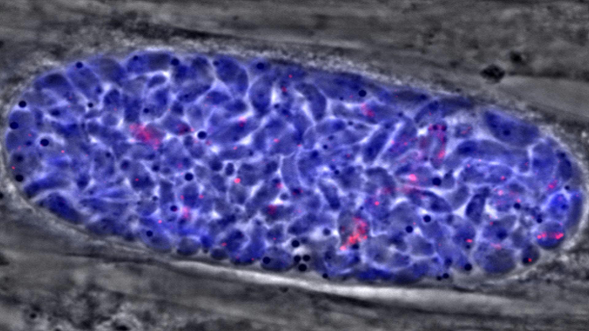 Stopping Toxoplasmosis Parasite Requires Interference With Digestion During Dormant Phase