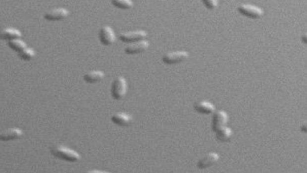 Study Explains Extraordinary Resilience of a Deadly Bacterium