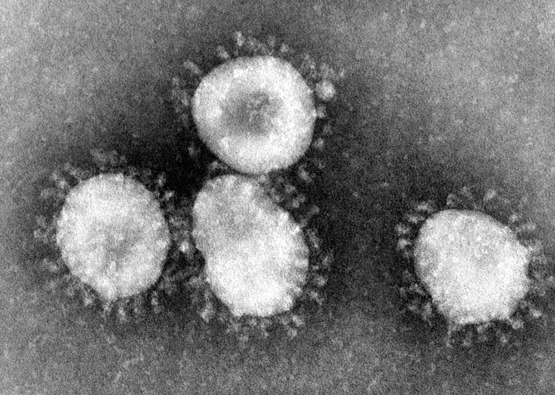 Coronavirus Case Confirmed in Washington State