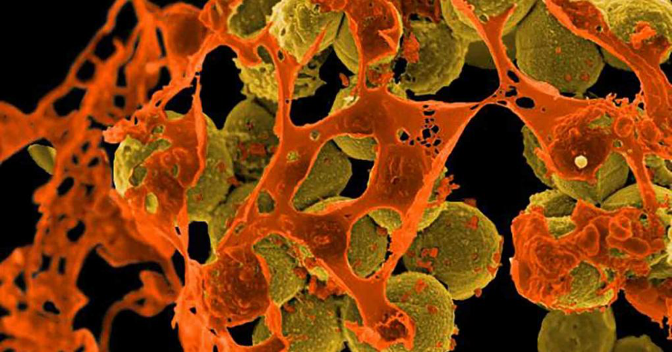 Newly Approved Test Can Diagnose MRSA in 5 Hours