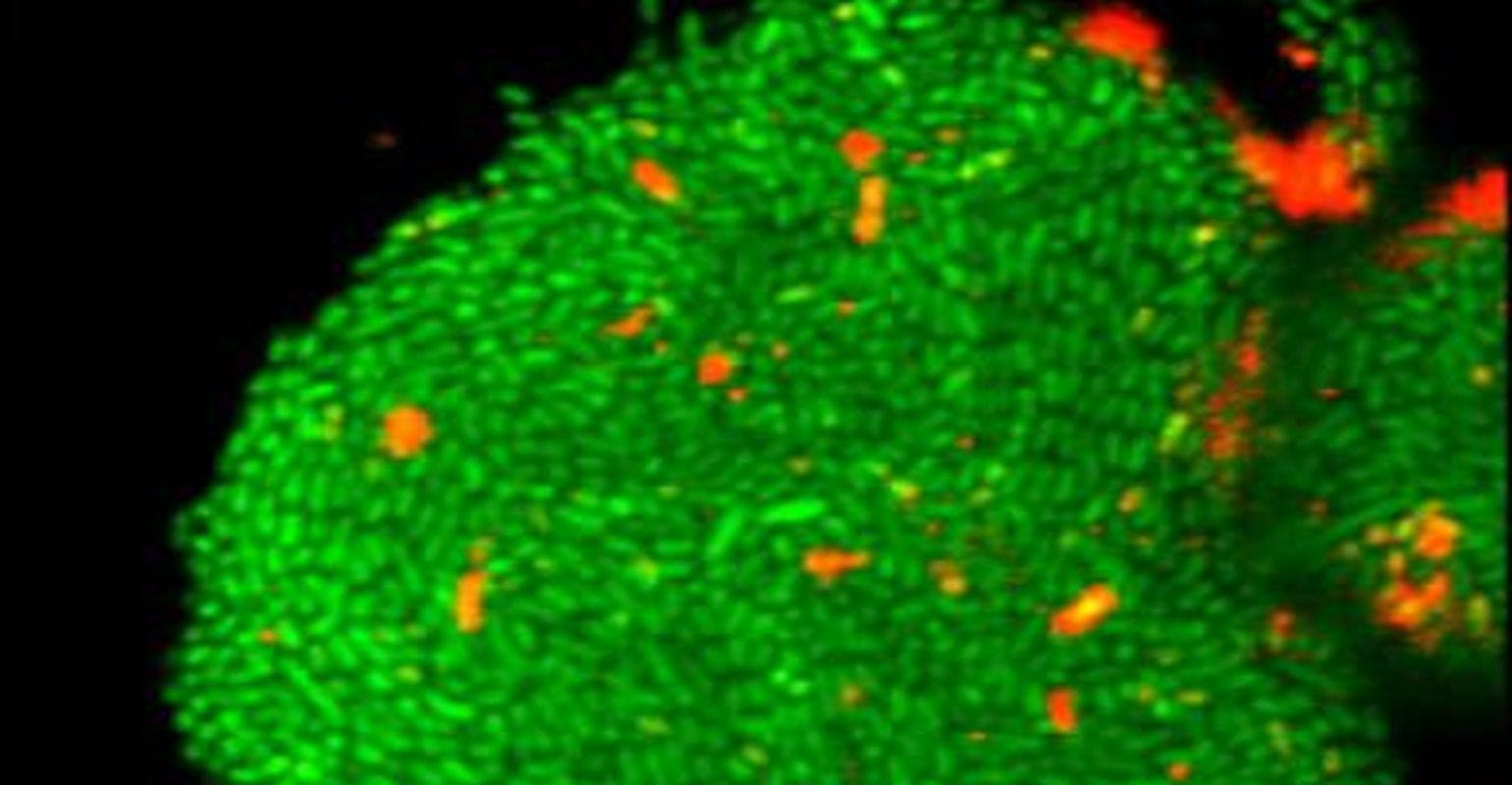 Researchers Discover How Fatal Biofilms Form