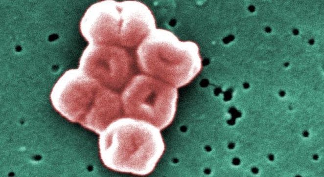 Improved Cleaning Needed to Fight Off Acinetobacter Baumannii