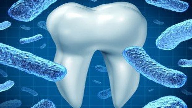 Researchers Add to Evidence That Bacterial Cause of Gum Disease May Drive Rheumatoid Arthritis
