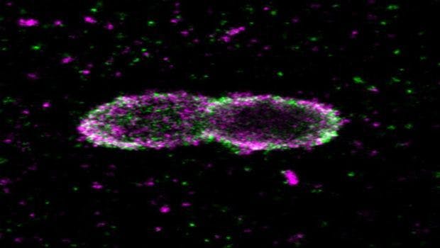 Researchers Study How Cells Combat Salmonella
