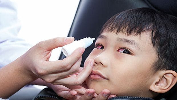 CDC Provides Tips on Conjunctivitis Symptoms, Treatment and Prevention