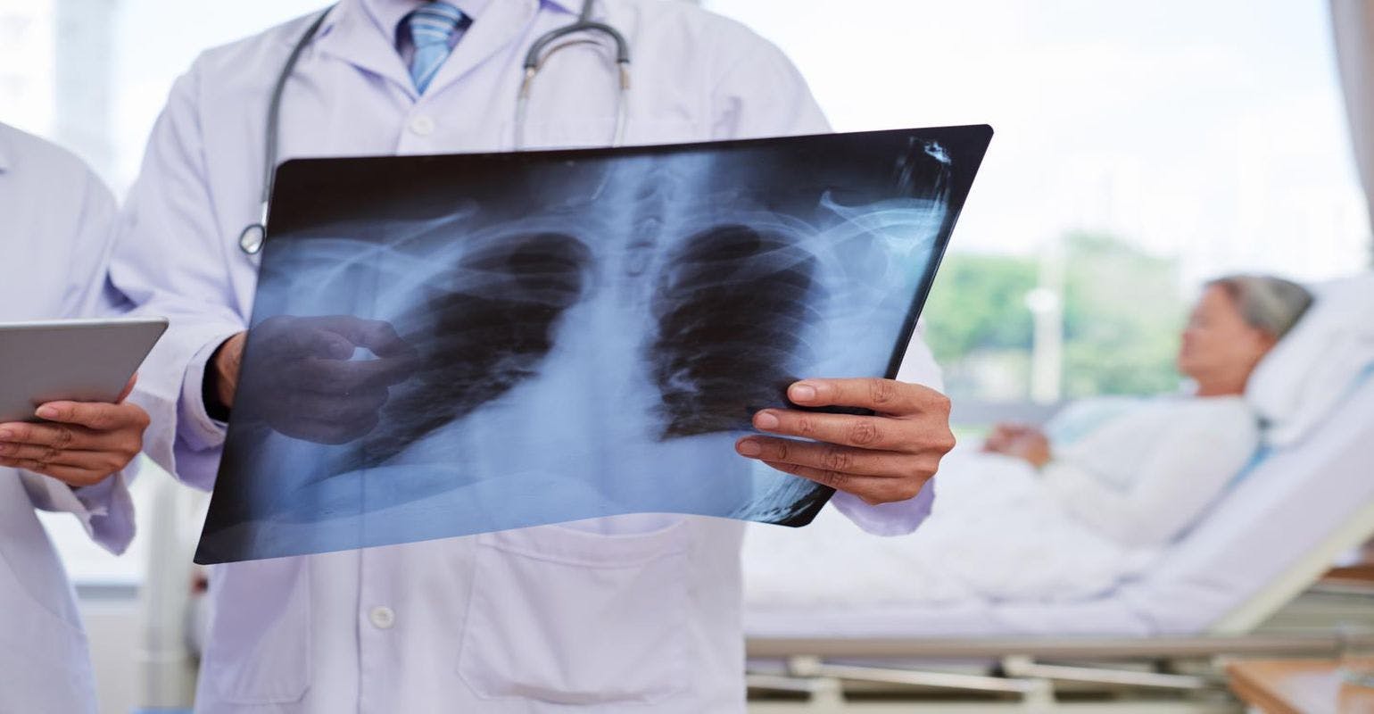 Clinician looking at a chest Xray.  (Adobe Stock, unknown)