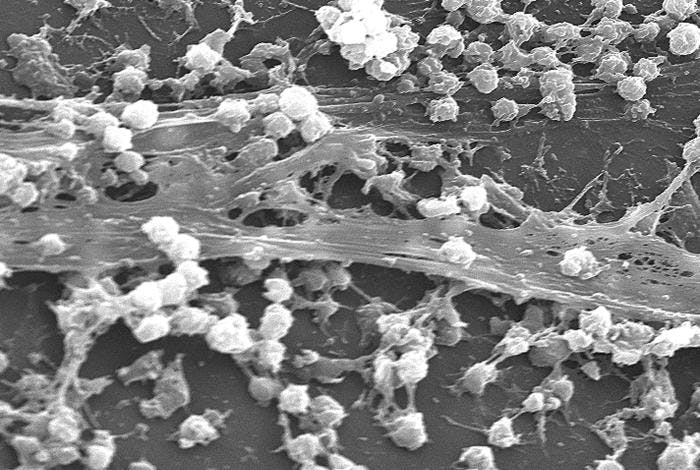 The sticky-looking substance woven between the round cocci bacteria, which was composed of polysaccharides, is biofilm. This biofilm protects bacteria—in this case Staphylococcus aureus—from attacks by antimicrobial agents such as antibiotics.

Source: Centers for Disease Control and Prevention