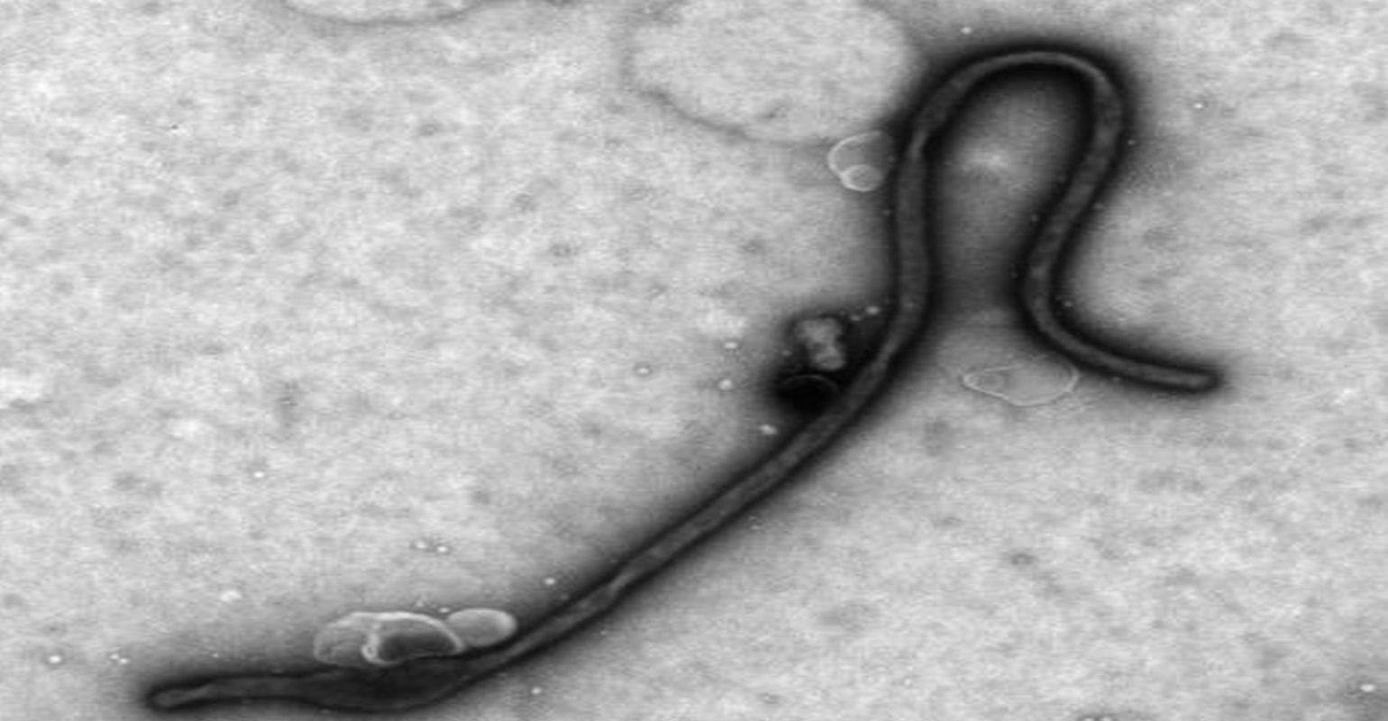 Ebola Virus Exploits Host Enzyme for Efficient Entry to Target Cells