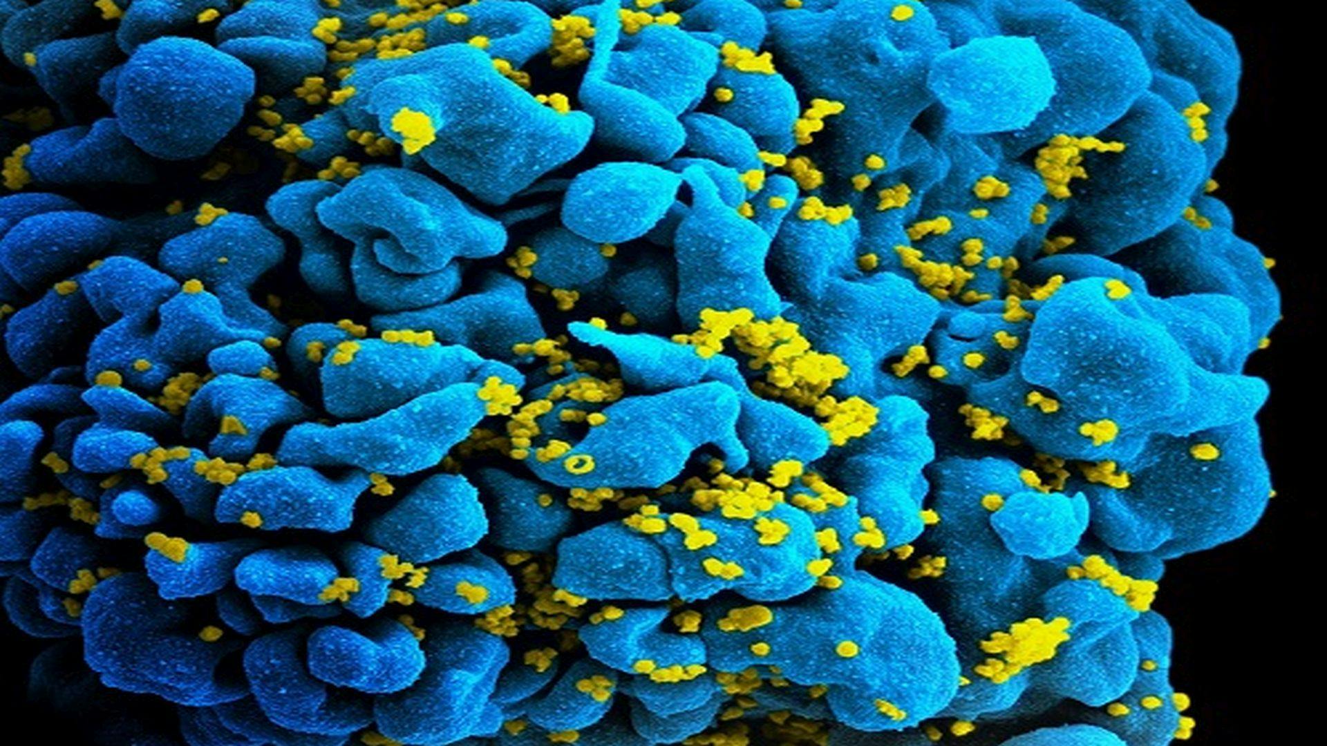 Gene Therapy Using CAR T-Cells Could Provide Long-Term Protection Against HIV