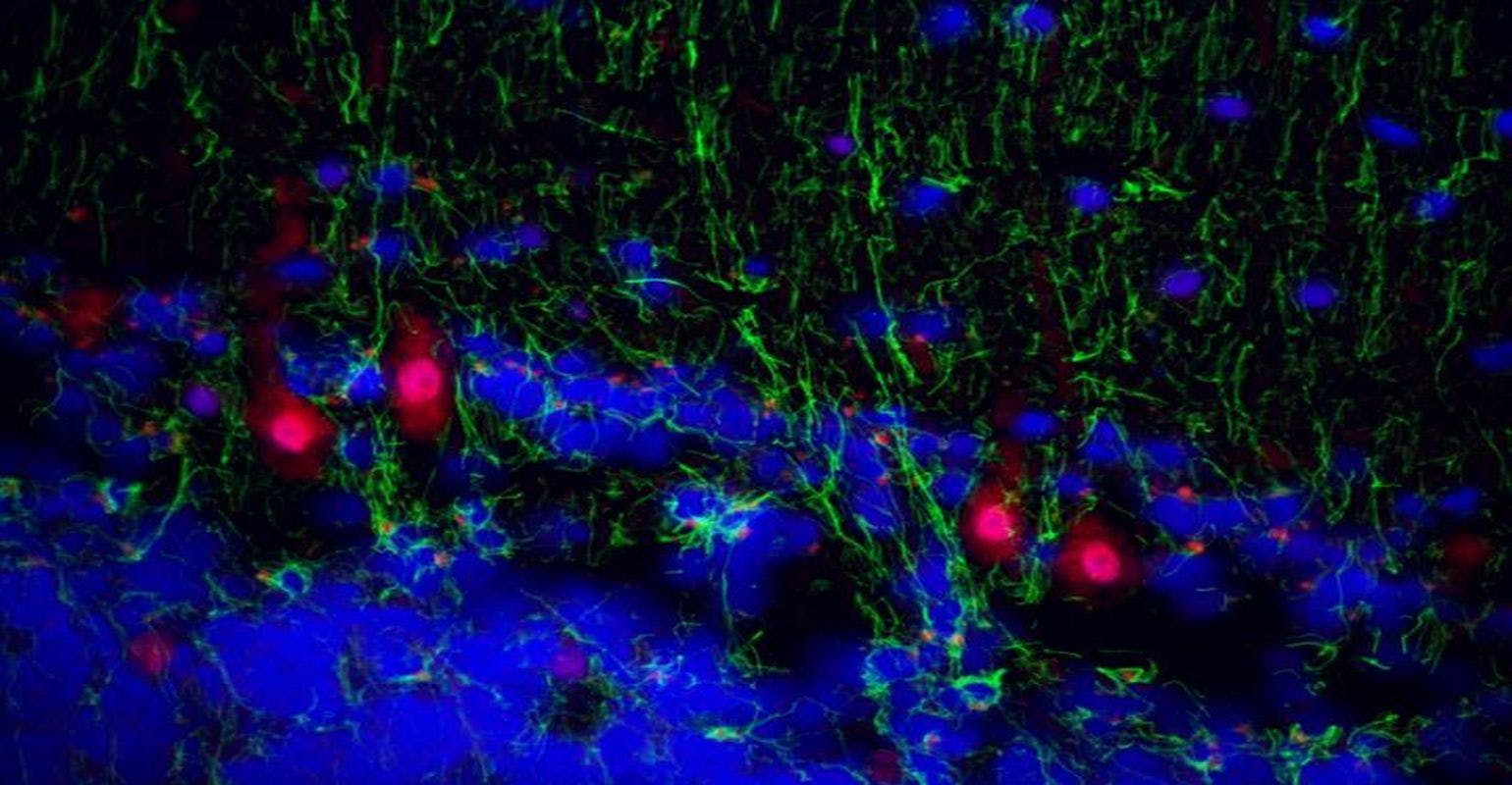 A Surprise Finding in Neurons