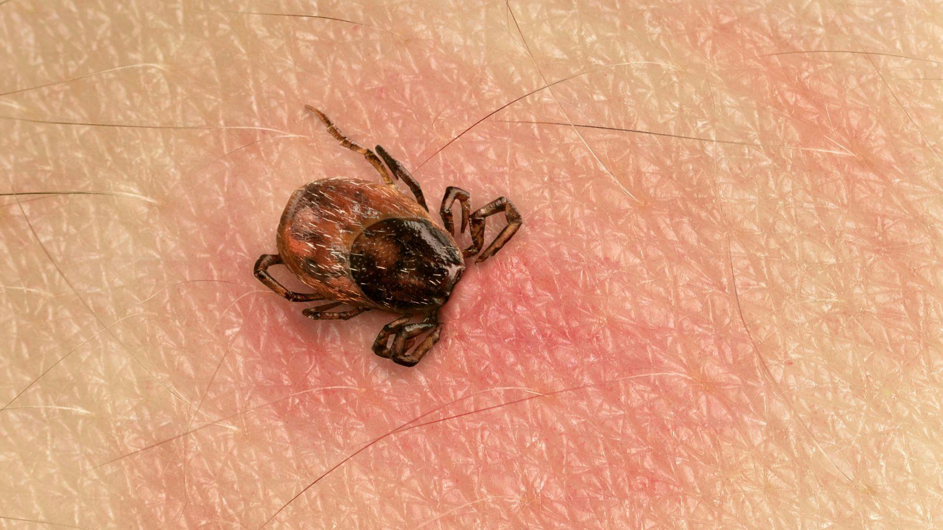 Study Shows Evidence of Severe and Lingering Symptoms in Some After Treatment for Lyme Disease