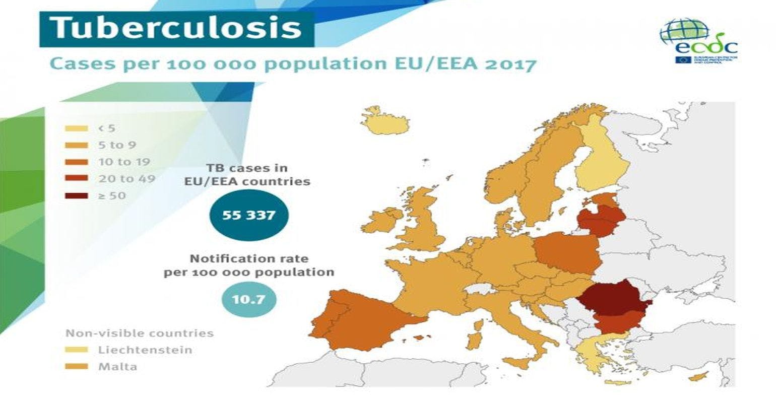 Every Hour, 30 People are Diagnosed With TB in the European Region