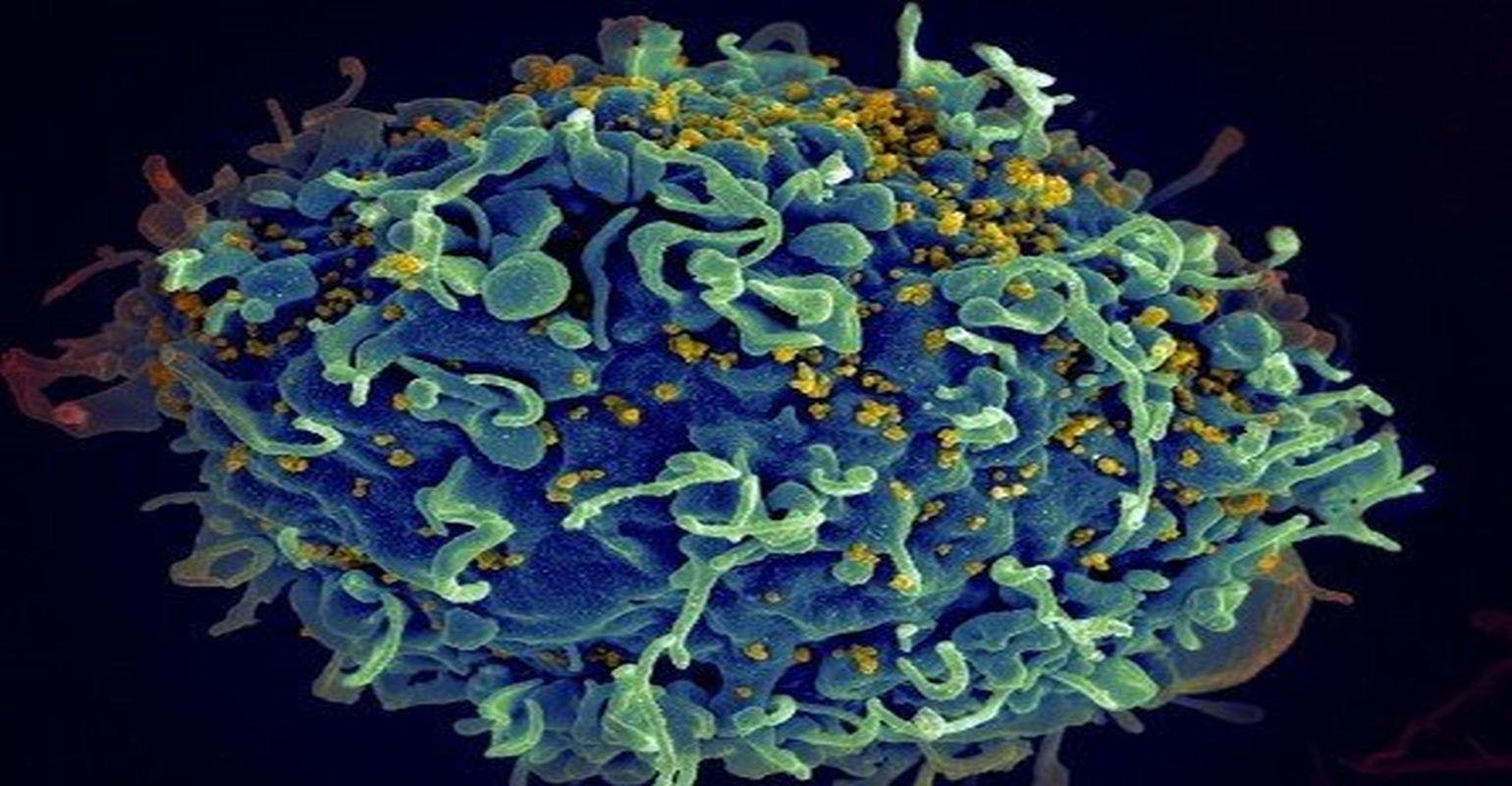 HIV Hidden in Patients’ Cells Can Now Be Accurately Measured