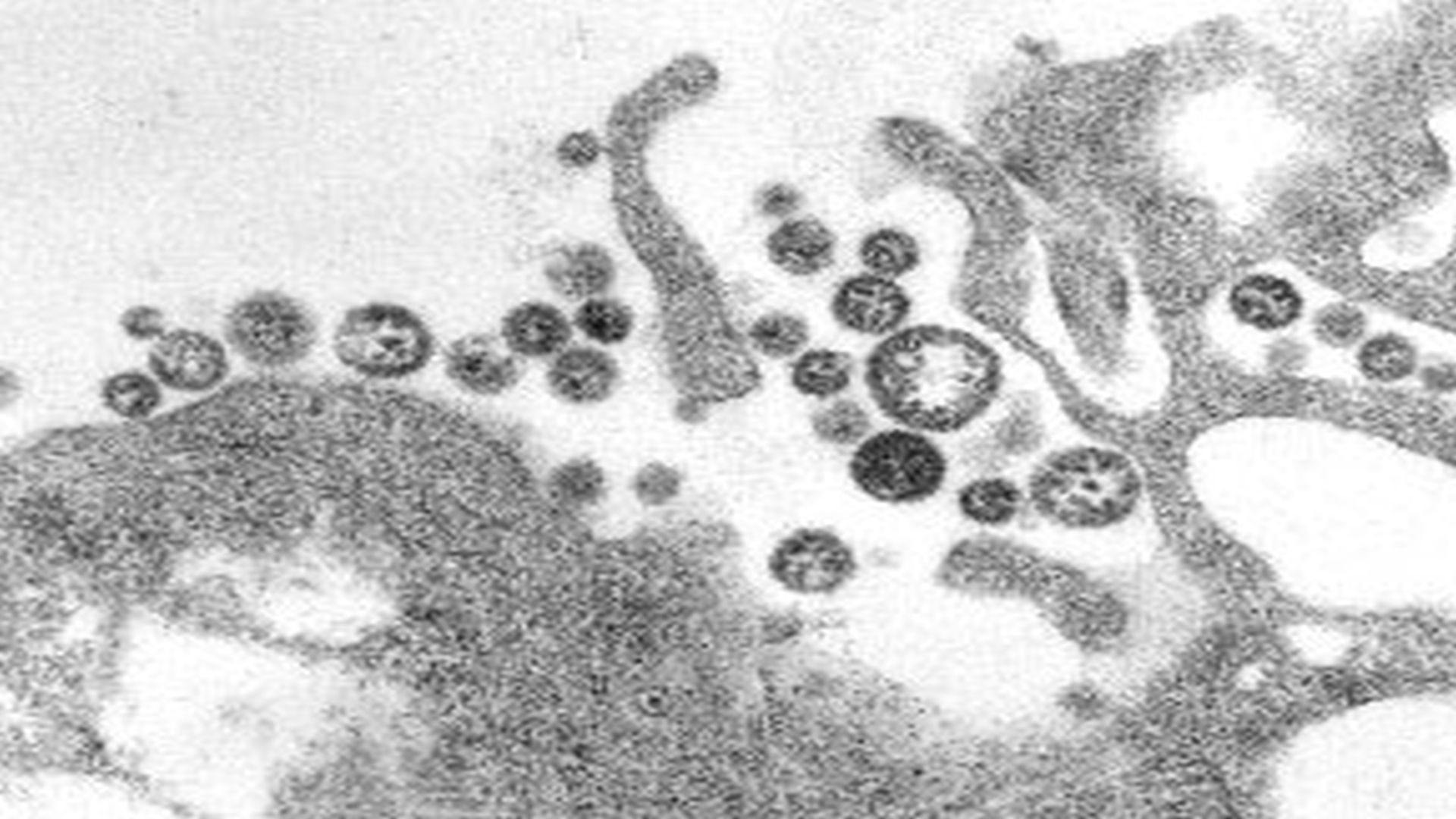 Researchers Develop Lassa Fever Treatment Effective Eight Days After Infection