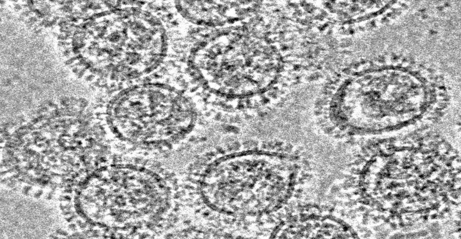 Anti-Flu Antibodies Can Inhibit Two Different Viral Proteins