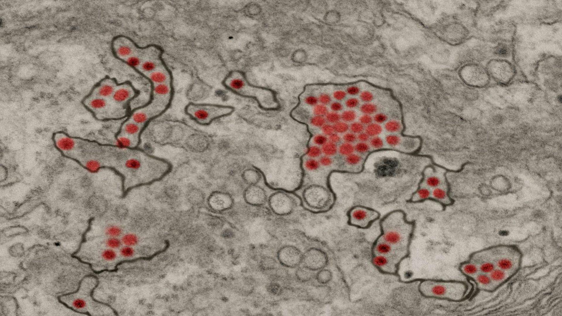 Monoclonal Antibodies Against Zika Show Promise in Primate Study